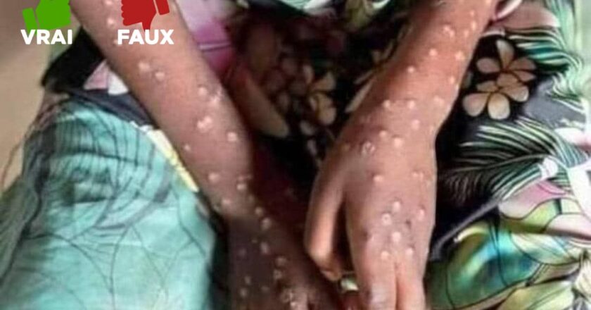 Faux : les épidémies ne seraient pas fabriquées en occident
