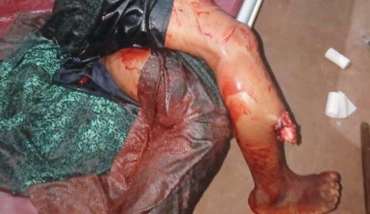 Uvira : Sange frappé par une nouvelle explosion meurtrière