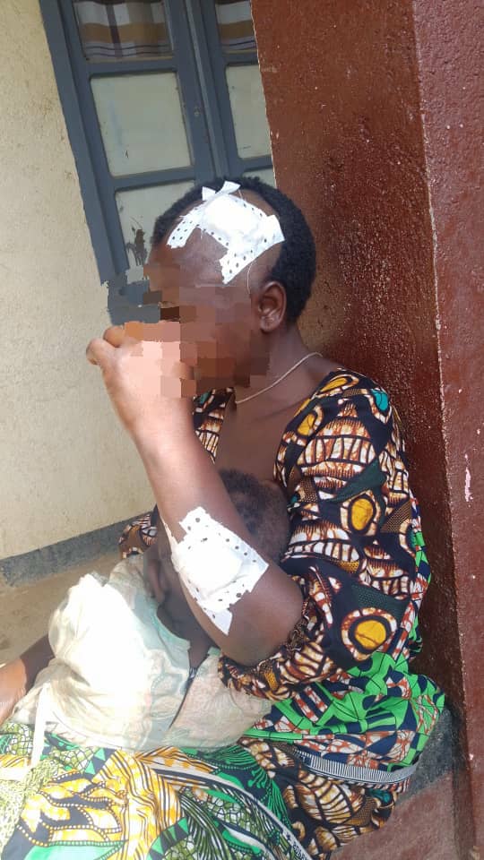 Madiwe : un homme blesse grièvement son épouse à la machette et prend la fuite